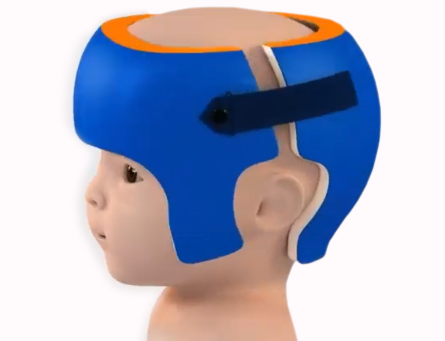 Casco ortopédico para bebé corrector de cabeza