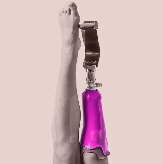 Material ortoprotésico Endosos para adquisición de material ortoprotésico en Rivas