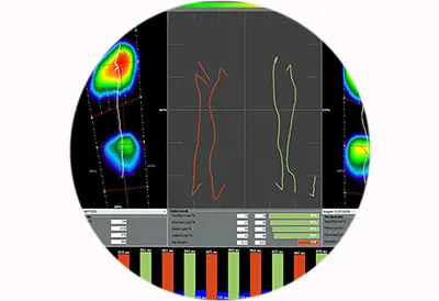 Software baropodométrico para el análisis de la pisada